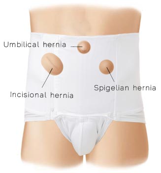 Underworks Mens Mid Incisional Hernia Brief Item # 951 Indications and features and benefits