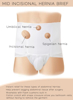 Underworks Hernia Support Brief Instant Relief for Umbilical hernia, Low Incisional Hernia and spigelian hernia