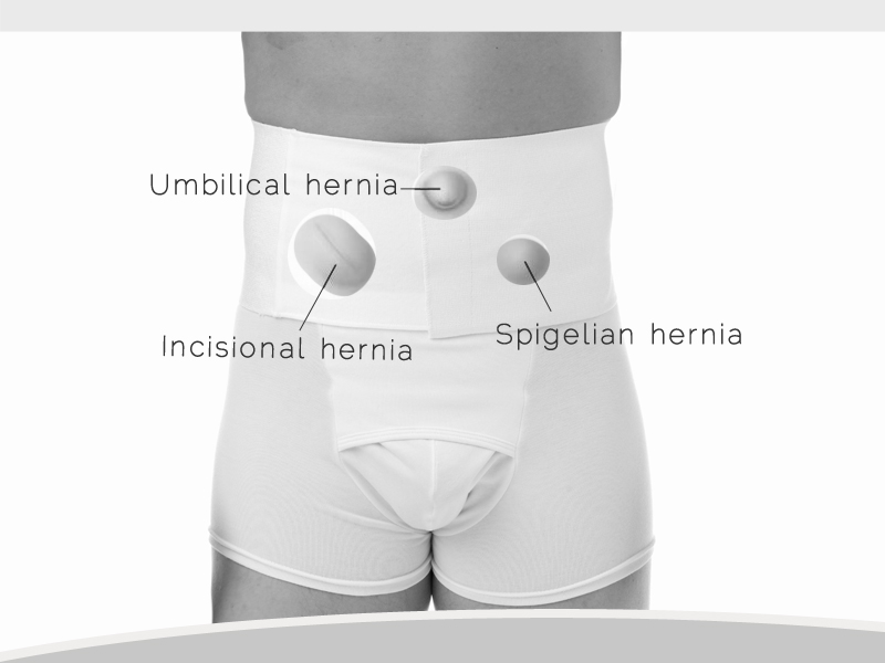 Underworks Men's and Women's Hernia Support Belt and Tummy Trimming 228