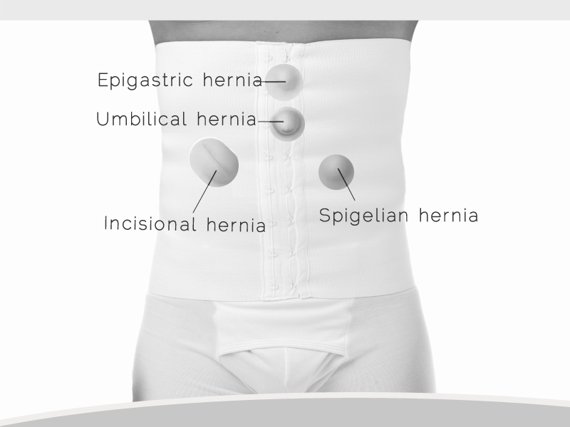 Underworks Men's and Women's Hernia Support 12-inch Tummy Trimming Belt with Hook n eye closure 343