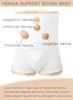 Hernia Support Boxer Brief instant relief abdominal hernias: Epigastric, Umbilical, Incisional, Spigelian
