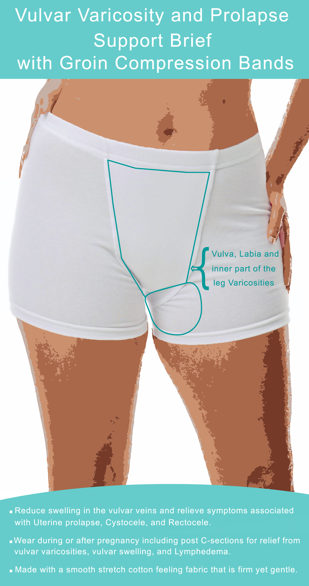 Underworks Vulvar Varicosity and Prolapse Support Boy-Leg Brief with Groin  Compression Bands