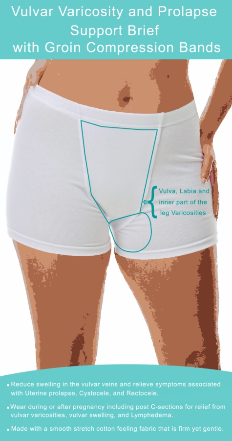 Underworks Vulvar Varicosity and Prolapse Support Boy-Leg Brief with ...